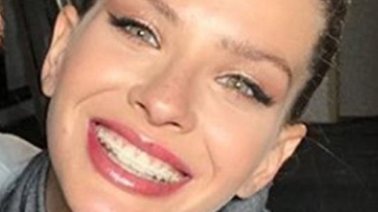 La sonrisa de la China Suárez sin brackets