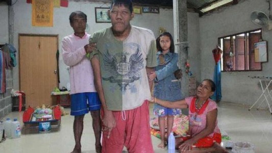 A los 26 años, murió el hombre más alto del mundo