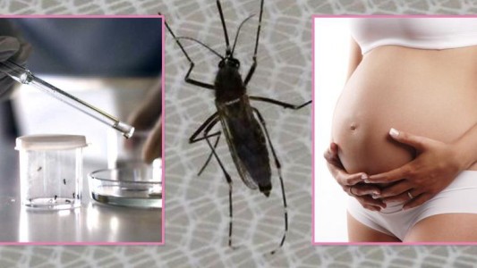 Nueva evidencia del vínculo entre el virus zika y malformaciones congénitas