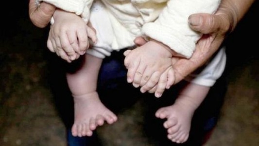 Familia de bebé con 31 dedos pide ayuda para operarlo