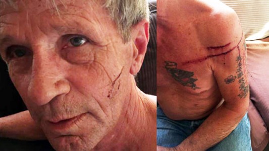 Así quedó el ex boxeador que se peleó con un oso en el bosque