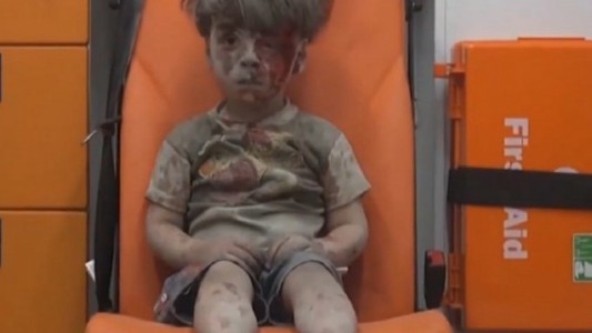 Otra tragedia golpeó a Omran, el nene sirio de la foto tras el bombardeo de Aleppo