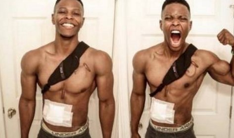 La emotiva historia del joven que no tiene corazón y espera un trasplante