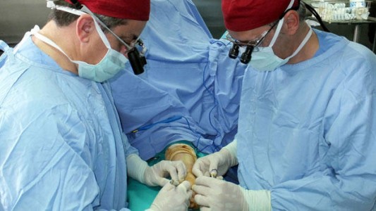 Condenado por amputarse una mano para cobrar el dinero del seguro