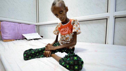 La foto de la joven que refleja el hambre en Yemen