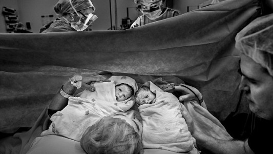 Una mujer quedó embarazada dos veces en 10 días