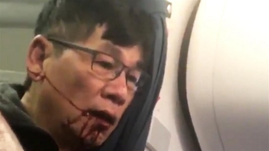 El pasajero que fue sacado del vuelo de United Airlines sufrió una conmoción cerebral