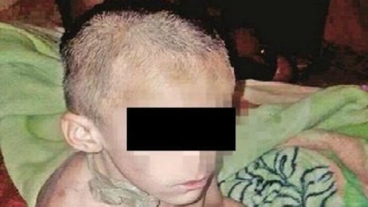 Conomoción en México: el terrible caso del nene que fue hallado encadenado, desnutrido y con signos de torturas