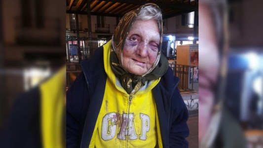 Conmoción en Madrid: un grupo de hombres golpearon brutalmente a una anciana que vivía en la calle