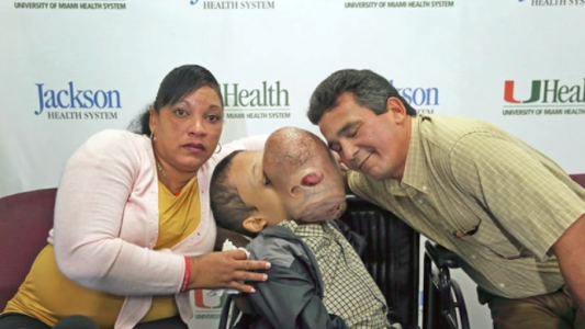 Extirparán un tumor de 4,5 kilos del rostro de un adolescente cubano