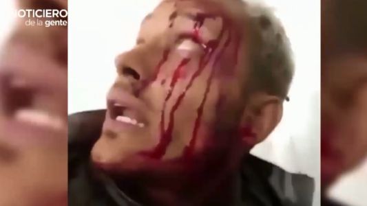 Confirman la muerte del policía rebelde en Venezuela