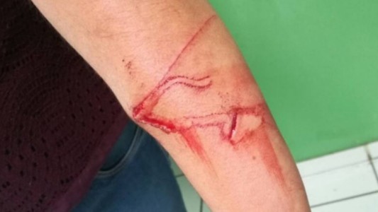 Un nene de 10 años acuchilló a su maestra para cumplir con un desafío viral