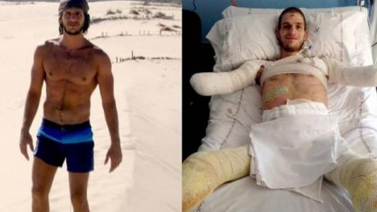 Le diagnosticaron una gripe, pero tenía meningitis: le tuvieron que amputar los brazos y las piernas