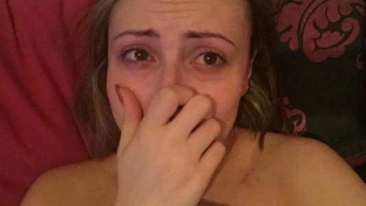 Una mujer se sacó una selfie minutos después de sufrir un ataque de pánico