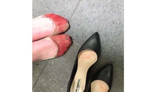 Denunció por Facebook que una empresa obliga a usar tacones aunque destrocen los pies