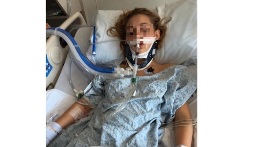 Publicó las fotos de su hija adolescente en coma para concientizar sobre el riesgo del alcohol