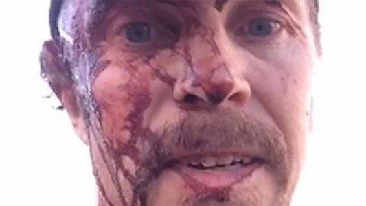 Así terminó el cazador que fue atacado dos veces por una osa