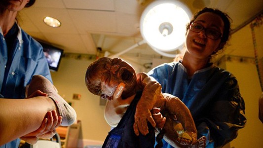 ¿No será mucho? una mujer llevó una cámara de fotos a su parto para fotografiar el momento