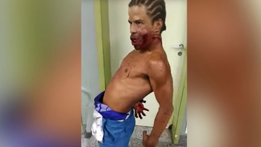Un hombre “poseído” generó terror en un hospital de Brasil