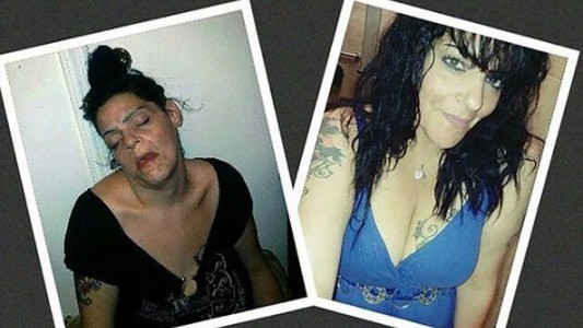 Adicta en recuperación publicó sus fotos del antes y el después para concientizar