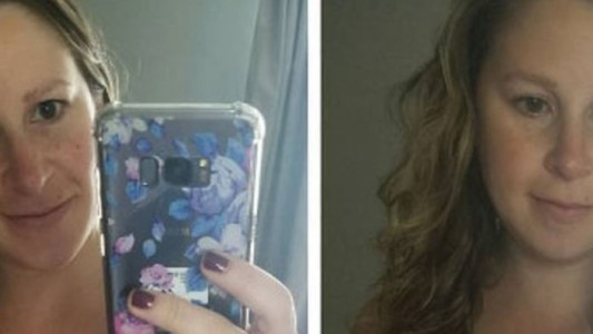 La mujer que muestra cómo le quedó la panza luego del parto