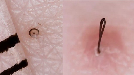 Furor en Instagrampor una extraña cuenta de "pelos encarnados"