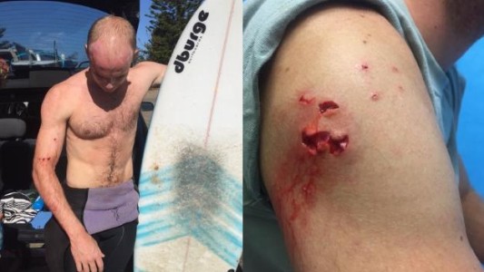 Lo atacó un tiburón mientras surfeaba y se salvó al recordar un video que vio en YouTube