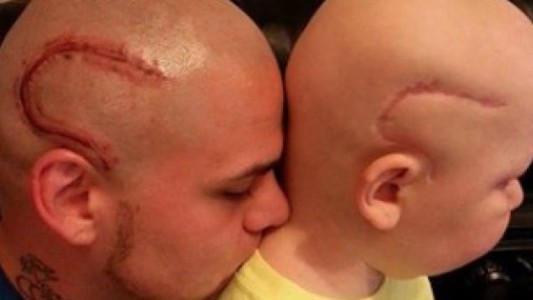 La conmovedora carta de despedida de padre que se tatuó en la cabeza la cicatriz que tenía su hijo