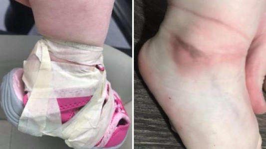 Guardería del terror: le ponen cinta adhesiva en los pies a una nena para que no se le salgan las zapatillas