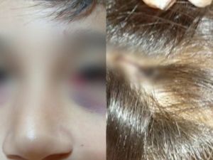 Mar del Plata: apuñalaron a un nene de 13 años con una lapicera