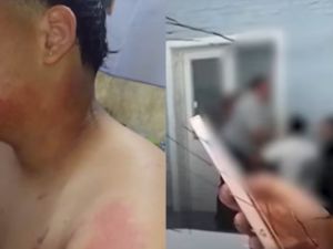 Una chica quemó a un compañero de clase con agua caliente