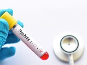 Alerta sífilis: en 2025 hubo más de 46.000 casos