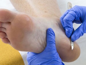 Cuando los pies hablan de nuestra salud: qué enfermedades del cuerpo pueden detectarse a tiempo con una consulta al podólogo