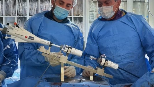 Se realizó el primer implante percutáneo para pacientes de alto riesgo en San Luis