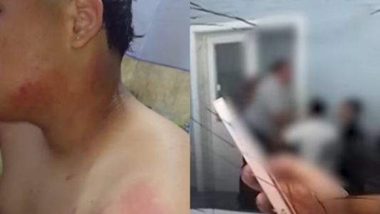 Una chica quemó a un compañero de clase con agua caliente