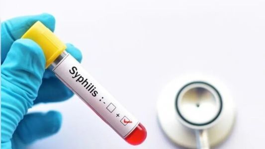 Alerta sífilis: en 2025 hubo más de 46.000 casos