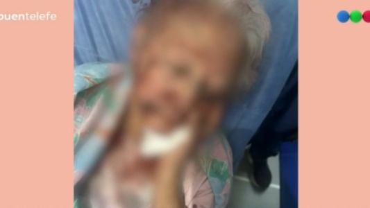 Brutal asalto a una jubilada en Cañuelas: la golpearon con un caño mientras dormía