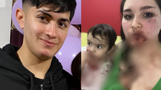 "No sé cómo seguimos vivas": la carta de la joven que fue apuñalada en la cara por su pareja