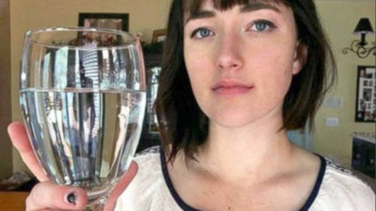 El extraño caso de la mujer que le tiene alergia al agua