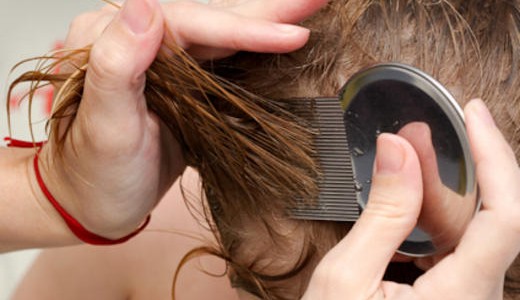 Piojos: advierten sobre el peligro de las infecciones derivadas de la pediculosis