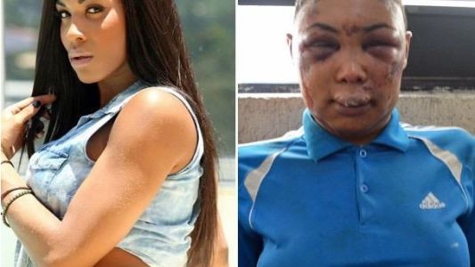 Mujer transgénero brasileña acusa a la policía de darle brutal paliza