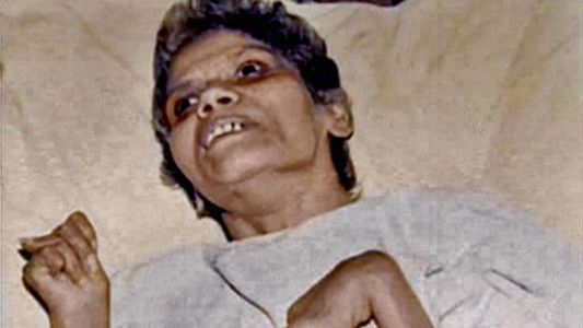 Murió una enfermera que estuvo 42 años en coma tras ser violada