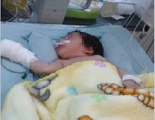 Queman con un caloventor a una beba en una clínica de Tucumán