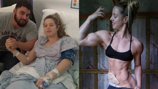 Estuvo cerca de morir, le colocaron una bolsa de colostomia y ganó un torneo de fisicoculturismo