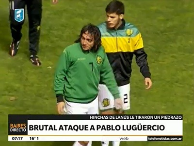 Hinchas visitantes en Mar del Plata le pegaron un piedrazo a Lugüercio