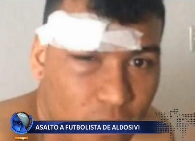 Asaltaron a un futbolista de Aldosivi