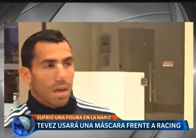 Tevez usará una máscara frente Racing