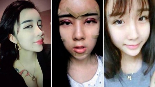 La chica que se operó toda para reconquistar a su novio