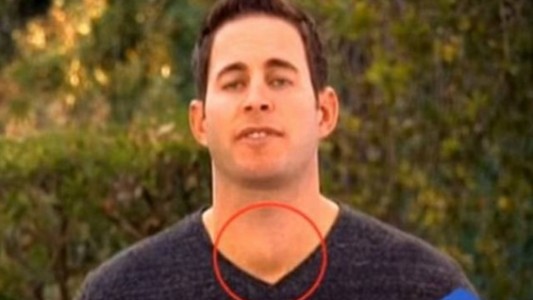 El conductor de tv que se salvó de un cáncer gracias a una televidente