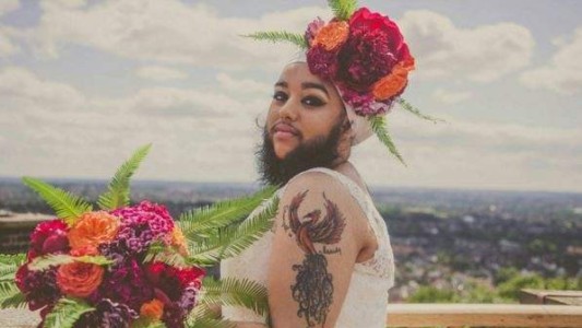 La historia de la "mujer barbuda" que lucha contra el bullying